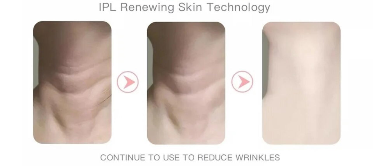 LED Beauty Machine